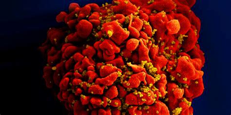 Hiv Elimination Scientists Report Zero Infections After Anti Viral Trials