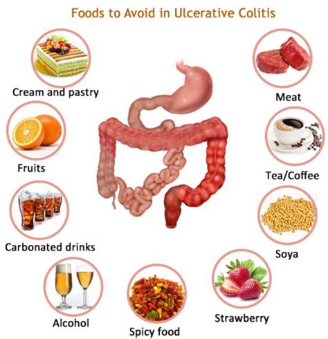 Diet And Home Remedies For Ulcerative Colitis Theayurveda