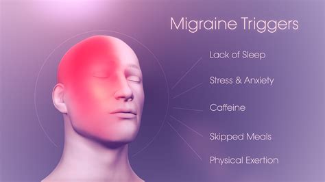 3d Medical Animation Depicting Migraine Scientific Animations