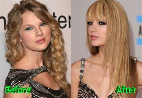 Taylor Swift Plastic Surgery Before And After