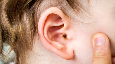 Ear Wax Children And Teens Raising Children Network