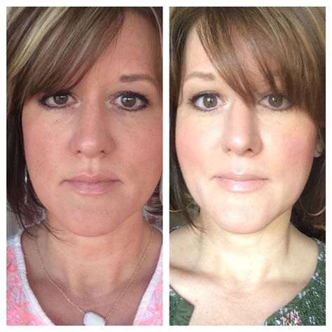 Picture On Left After One Month Of Using Luminesce Picture On The