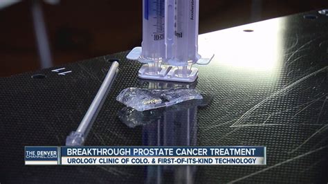 Breakthrough Prostate Cancer Treatment From Colorado Now Fda Approved