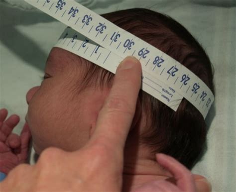 Head Newborn Nursery Stanford Medicine