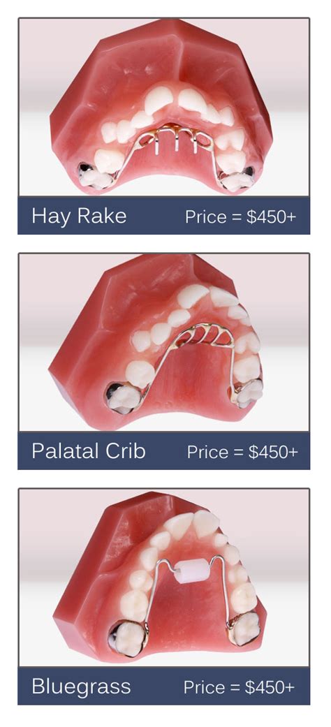 Orthodontic Solutions To Thumb Sucking And Their Cost Thumbguard