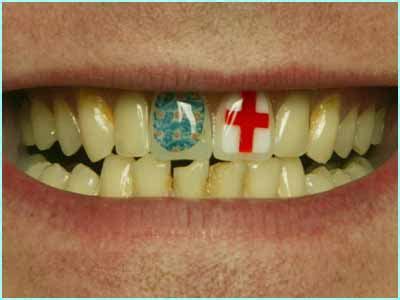 Maybe you would like to learn more about one of these? Do people in England really have bad teeth? - Bodybuilding ...