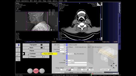 Ct Scan Of Neck With Contrast Full Process Youtube
