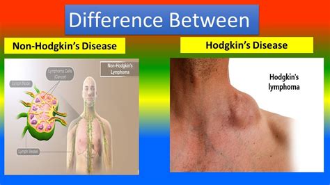 Difference Between Non Hodgkins Disease And Hodgkins Disease Youtube