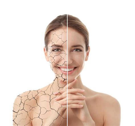 Premium Photo Collage With Photos Of Woman Having Dry Skin Problem