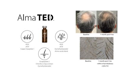 Ted Hair Rejuvenation Treatment Shot Shop Med Spa