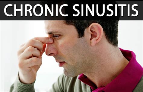 Chronic Sinusitis Causes Symptoms Surgery And Treatment