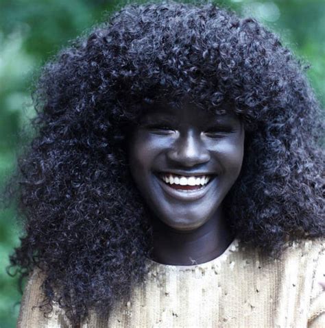 Teen Bullied For Incredibly Dark Skin Color Becomes Model Takes