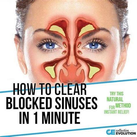 How To Clear Seriously Blocked Sinuses Naturally In 1 Minute With This