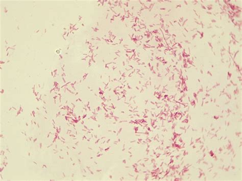 Micrograph Escherichia Coli Gram Stain 1000x P000007 Oer Commons