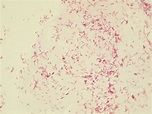 Micrograph Escherichia coli Gram stain 1000x p000007 | OER Commons