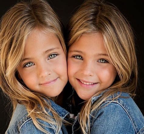 8 Years Ago They Were Called The Most Beautiful Twins In The World Heres What They Look Today