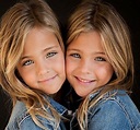 When They Were Born People Said They Were The Most Beautiful Twins In ...