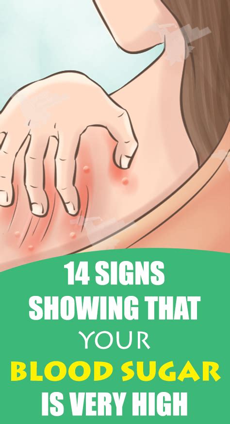 Signs Showing That Your Blood Sugar Is Very High