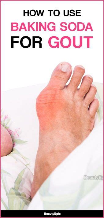 Baking Soda For Gout Gout How To Cure Gout Gout Remedies
