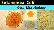 Entamoeba Coli Cyst Morphology - YouTube
