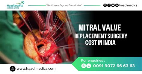 Mitral Valve Replacement Cost In India