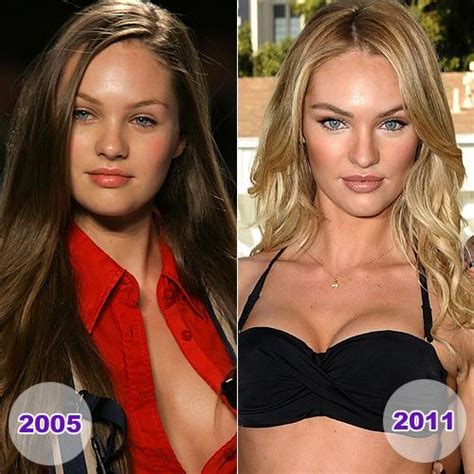 Even Though Candice Is Portrayed Perfect Through Photoshopped Pictures Dont Be Worried If Every