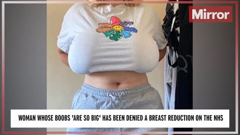 Womans Breasts Are So Big She Burnt Them On A Nandos Grill But The Nhs Wont Fund Her