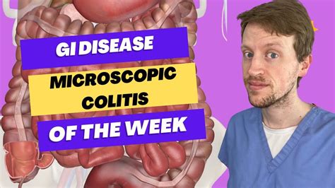 Microscopic Colitis In Under 90 Seconds Youtube