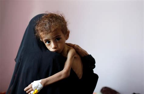 Un Warns Half The Population Of Yemen Could Soon Be On The Brink Of