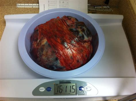 How is the diagnosis of spleen tumors made in cats and dogs? Lap of Love Veterinary Hospice: Bear vs the Splenic Tumor