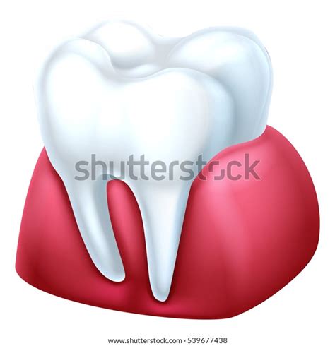 Dental Medical Illustration Tooth Gum Stock Vector Royalty Free 539677438