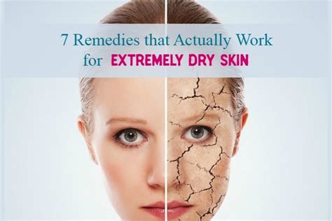 7 Tried And True Ways To Combat Extremely Dry Skin Pretty Opinionated