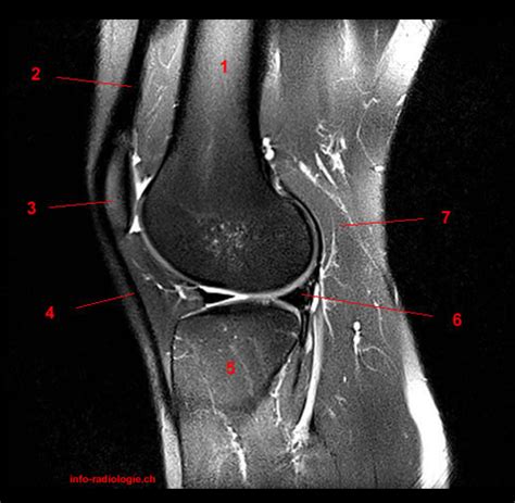 The muscles that affect the knee's movement run along the thigh and calf. i love physical therapy: Atlas of knee MRI anatomy