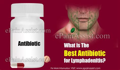 What Is The Best Antibiotic For Lymphadenitis