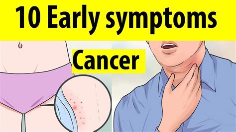 10 early symptoms of cancer in men may be ignoring early signs of cancer youtube