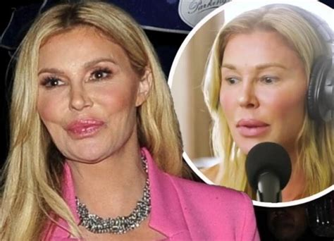 Brandi Glanvilles Bad Plastic Surgery 2024 View Before And After Photographs