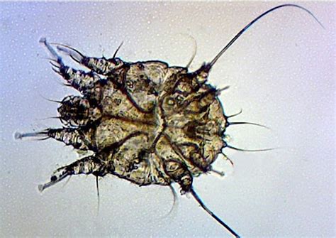 Island Urgent Care Blog Medical Monday How Scary Is Scabies