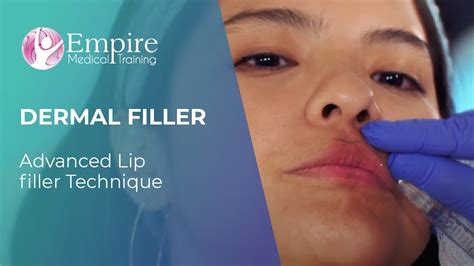 Advanced Lip Filler Technique Youtube