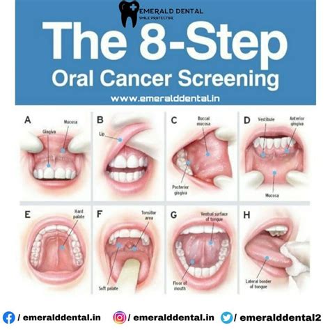Oral Cancer Screening Emerald Dental