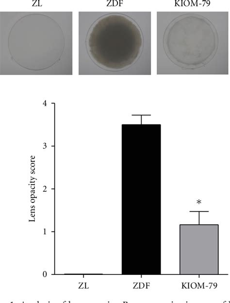 Figure 1 From KIOM 79 Prevents Lens Epithelial Cell Apoptosis And Lens