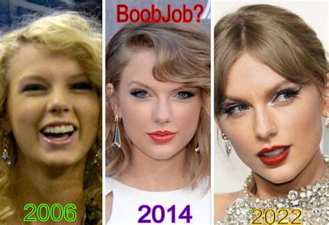 Has Taylor Swift Had Plastic Surgery Archives Love And Wants