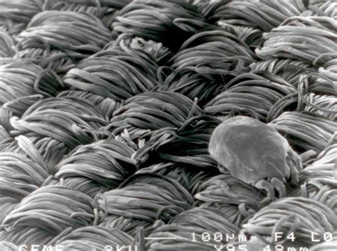 Unlike bed bugs, bed mites don't feed on blood. Preventing Dust Mites in Pillows and Bedding - The New ...