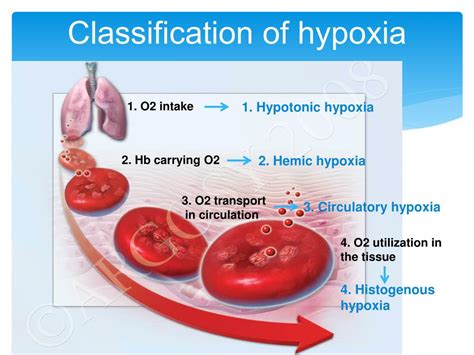 Ppt Hypoxia Powerpoint Presentation Free Download Id 5655356