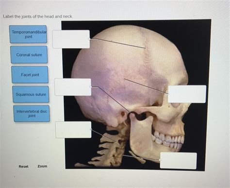 Solved Label The Joints Of The Head And Neck