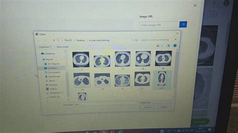 Covid 19 Early Detection Using Ct Scan Images Youtube