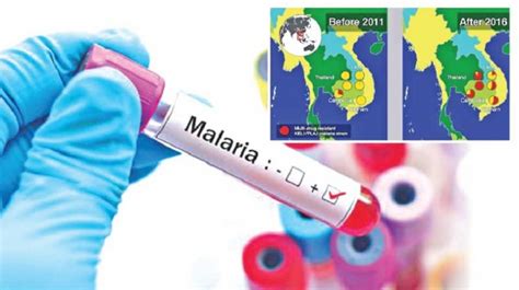 Drug Resistant Malaria Is Curable