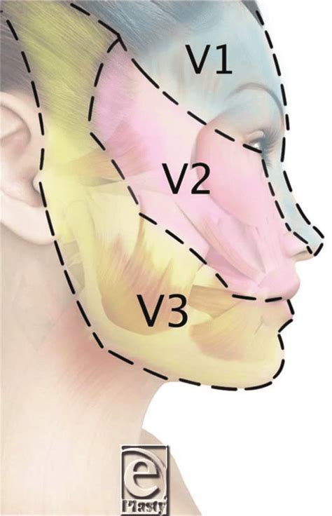 Territories Of The Trigeminal Nerve Ophthalmic Nerve V1 Maxillary