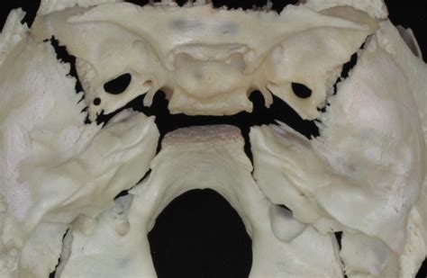Superior View Of The Skull Base Neuroanatomy The Neurosurgical Atlas