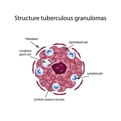 Tb Structure