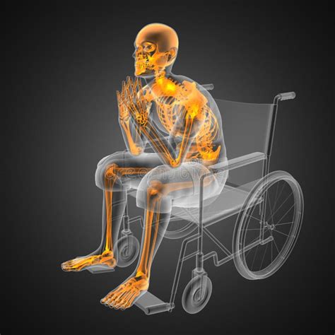 Skeleton Wheelchair Stock Illustrations 355 Skeleton Wheelchair Stock